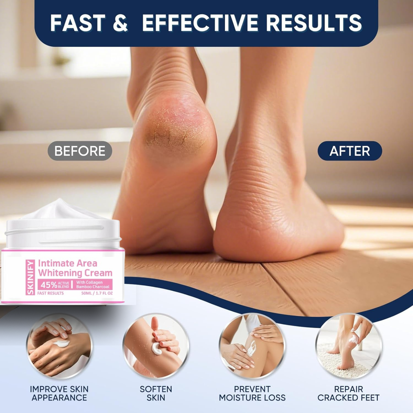 Intimate Area Whitening Cream